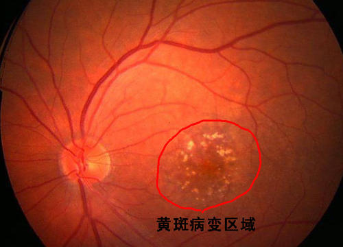 世界爱眼日是几月几日日_世界爱眼日是每年的多少号_世界爱眼日是每年的几月几号